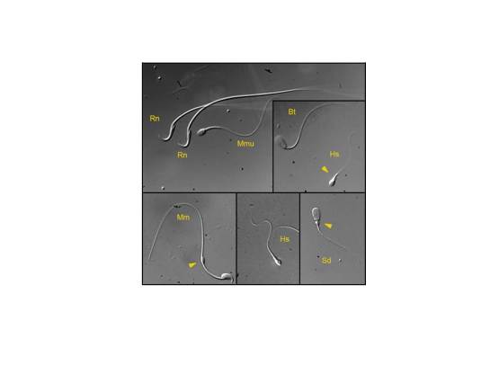 Fig. 1. Examples of sperm morphological diversity. Spermatozoa of different species are shown with cytoplasmic droplets indicated by yellow arrows. Shown are: human (Hs; Homo sapiens), mouse (Mm; Mus musculus), rat (Rn; Rattus norvegicus), rhesus macaque (Mmu; Macaca mulatta), boar (Sd; sus scrofadomesticus), and bull (Bt; Bos taurus) sperm cells.