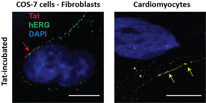 This figure shows that HIV-Tat is detected intracellularly in human cardiomyocytes but not simian fibroblasts (COS-7), after a 24h external application (200 ng/ml). Tat immunostaining is shown in red, plasma membrane is identified by hERG channel immunostaining (green), nucleus is in blue (DAPI). Tat remains in the extracellular compartment of COS-7 cells (red arrow) while in human cardiomyocytes, Tat is located inside the cytoplasm (asterisks) and colocalizes with hERG at the plasma membrane (yellow arrows).* (Adapted from Es-Salah-Lamoureux et al, 2016, JMCC 99:1-13, with permission.)