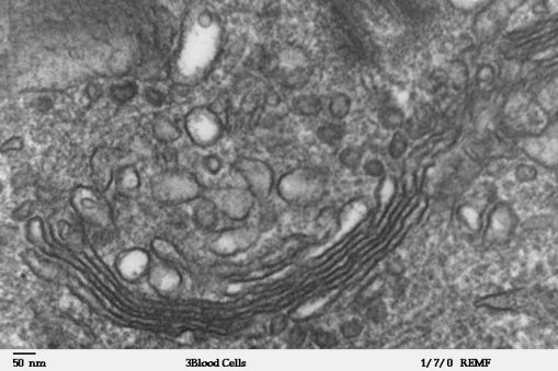 TEM image of white blood cell (taken from Science Learning Hub – Pokapū Akoranga Pūtaiao, University of Waikato)