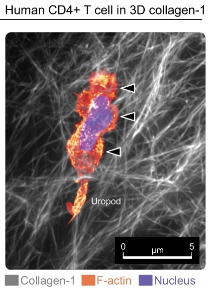 Experimental image of bleb-mediated migration by a T cell (from Tabdanov et al 2021, Nat Comm https://www.nature.com/articles/s41467-021-22985-5)