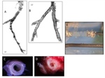 Molecular Mechanics & Asthma