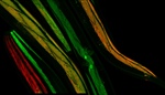 The Science Behind the Image Contest Winners: Fluorescent Muscles in Living C. elegans
