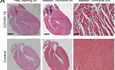 How COVID-19 Can Impact the Heart