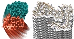 Understanding Alzheimer’s Disease through Biophysics Research