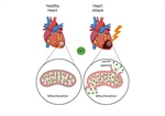 Historical Perspective on the Mitochondria Ca2+-Induced Transition in Ischemia-Reperfusion Injury