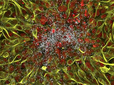 Mechanobiology of Infections - Ascona, Switzerland 2026