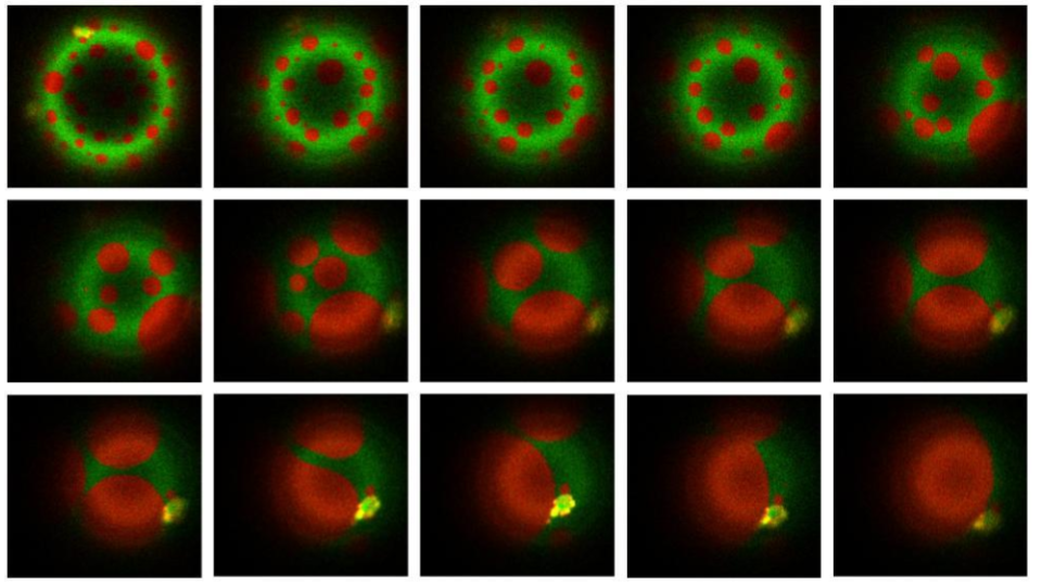 Researchers Discover How Tuberculosis Bacteria Use a “Stealth” Mechanism to Evade the Immune System
