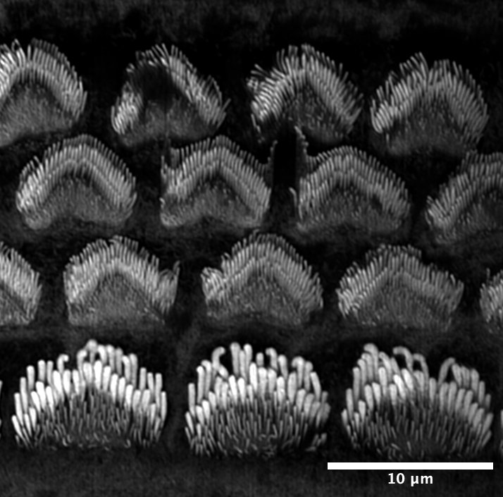 A Hidden Reason Inner Ear Cells Die – And What It Means for  Preventing Hearing Loss