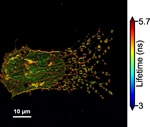 Announcing the Winners of the 2026 Beauty in Biophysics Image Contest