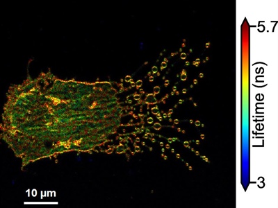 Announcing the Winners of the 2026 Beauty in Biophysics Image Contest