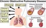 Molecular Mechanisms of Inflammatory Signaling in COPD