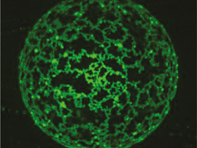 Molecular Biophysics of Membranes - Tahoe 2022