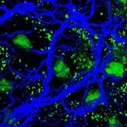 2024 Biological Fluorescence DINNER ONLY